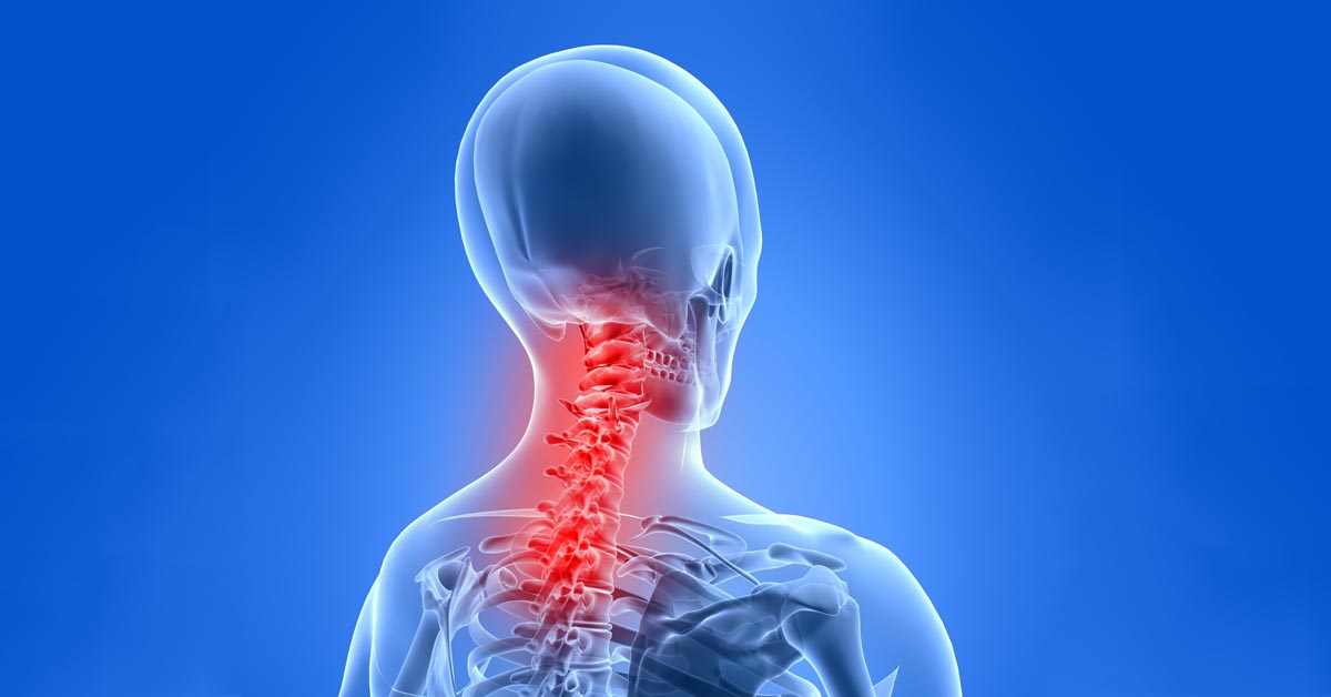 Burton, MI neck pain and headache treatment